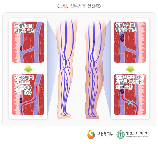 심 이미지