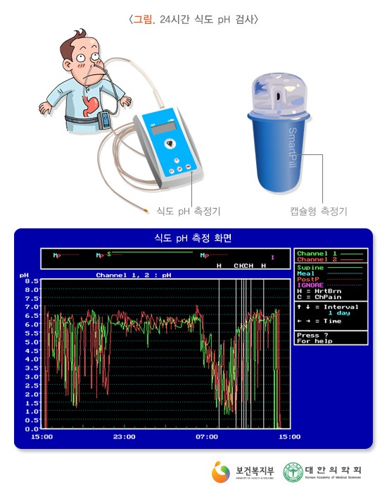 24�ð� �ĵ� pH �˻��