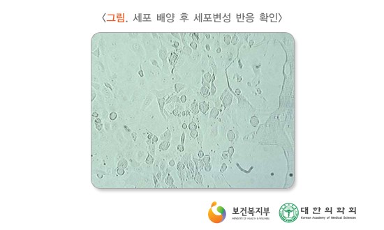 세포 배양 후 세포변성 반응 확인