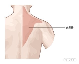 [그림1] 목 부위의 근육