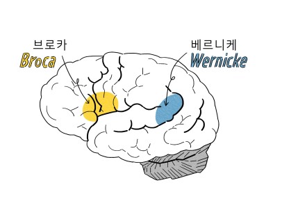 베르니케 이미지
